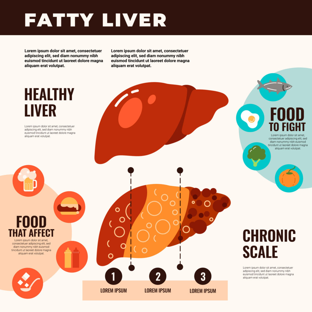 Curing Fatty Liver